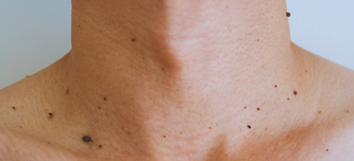 Understanding the Connection Between Stress and Skin_vitalbodyventura